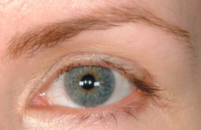 Eyelash Transplant and Implant Procedure